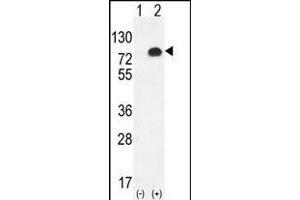 Western blot analysis of GPC6 (arrow) using rabbit polyclonal GPC6 Antibody (C-term) (ABIN655620 and ABIN2845100). (Glypican 6 anticorps  (C-Term))