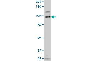 SRPK1 monoclonal antibody (M10A), clone 4G12 Western Blot analysis of SRPK1 expression in Jurkat . (SRPK1 anticorps  (AA 371-470))