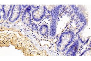 Detection of CALD in Rat Colon Tissue using Polyclonal Antibody to Caldesmon (CALD) (Caldesmon anticorps  (AA 434-531))