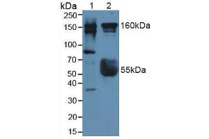 Figure. (ROCK2 anticorps  (AA 904-1140))
