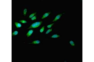 Immunofluorescent analysis of Hela cells using ABIN7162519 at dilution of 1:100 and Alexa Fluor 488-congugated AffiniPure Goat Anti-Rabbit IgG(H+L)