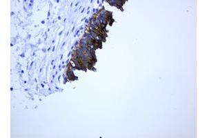 Image no. 1 for anti-ATP-Binding Cassette, Sub-Family B (MDR/TAP), Member 1 (ABCB1) (AA 995-1280) antibody (ABIN1491724)