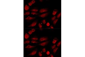 Immunofluorescence analysis of U20S cell using TP53BP1 antibody.