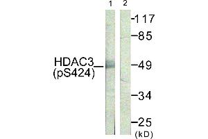 Immunohistochemistry analysis of paraffin-embedded human skin tissue using HDAC3 (Phospho-Ser424) antibody. (HDAC3 anticorps  (pSer424))