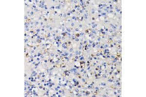Immunohistochemistry of paraffin-embedded human spleen using CD11a/LFA-1A/ITGAL Rabbit mAb (ABIN7267923) at dilution of 1:100 (40x lens). (ITGAL anticorps)