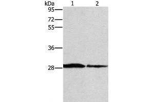 Western Blot analysis of Human chromaffin cell tumor tissue and lovo cell using SPR Polyclonal Antibody at dilution of 1:1500 (SPR anticorps)