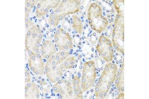 Immunohistochemistry of paraffin-embedded mouse kidney using PSTPIP1 antibody. (PSTPIP1 anticorps  (AA 157-416))