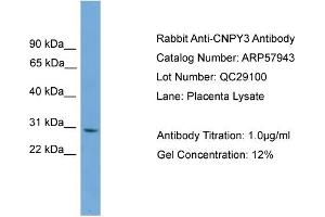 WB Suggested Anti-CNPY3  Antibody Titration: 0. (TNRC5 anticorps  (Middle Region))