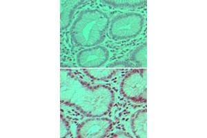 Image no. 1 for anti-Ubiquitin Specific Peptidase 7 (Herpes Virus-Associated) (USP7) (AA 30-80) antibody (ABIN960400) (USP7 anticorps  (AA 30-80))