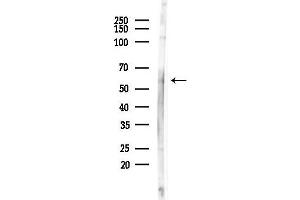 Western blot analysis of lysates from COLO205 cells(heat-shock,45 min treatment), using Phospho-Tyrosine Hydroxylase (Ser19) Antibody at 1/1000 dilution.