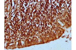 IHC image of ABIN7157277 diluted at 1:300 and staining in paraffin-embedded human lung tissue performed on a Leica BondTM system.