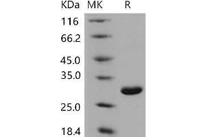 Western Blotting (WB) image for Ubiquitin Carboxyl-terminal Esterase L1 (Ubiquitin Thiolesterase) (UCHL1) (Active) protein (His tag) (ABIN7198557)