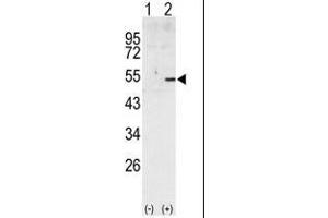 Western blot analysis of CCNA2 (arrow) using rabbit polyclonal CCNA2 Antibody (Cyclin A anticorps  (C-Term))