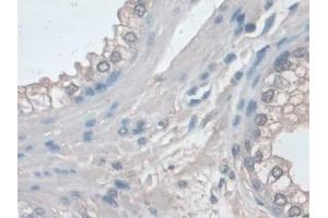 Detection of ERK1 in Human Prostate Tissue using Polyclonal Antibody to Extracellular Signal Regulated Kinase 1 (ERK1)