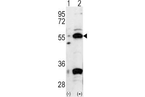 Western Blotting (WB) image for anti-Pancreatic and Duodenal Homeobox 1 (PDX1) antibody (ABIN3001418) (PDX1 anticorps)