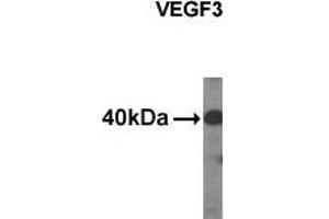 Western analysis of extracts from HDMEC cells using VEGF3 antibody. (VEGFC anticorps  (C-Term, N-Term))
