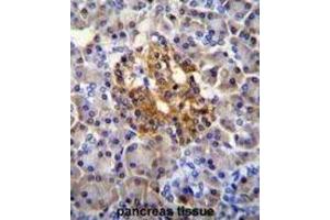 Immunohistochemistry (IHC) image for anti-Nucleotide-Binding Oligomerization Domain Containing 1 (NOD1) antibody (ABIN2996386)