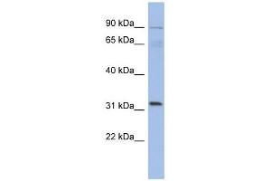 TBC1D14 antibody used at 1 ug/ml to detect target protein. (TBC1D14 anticorps  (N-Term))