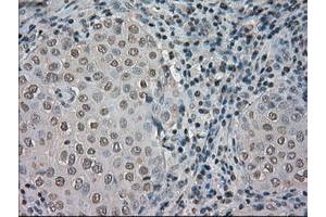 Image no. 1 for anti-Neurotrophic tyrosine Kinase, Receptor, Type 3 (NTRK3) antibody (ABIN1499842)