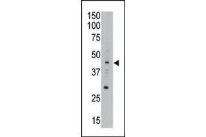 Image no. 1 for anti-Apolipoprotein B mRNA Editing Enzyme, Catalytic Polypeptide-Like 3G (APOBEC3G) (Middle Region) antibody (ABIN356858) (APOBEC3G anticorps  (Middle Region))