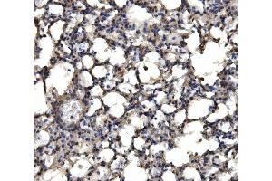 IHC analysis of delta 1 Catenin/CAS/CTNND1 using anti-delta 1 Catenin/CAS/CTNND1 antibody (ABIN7602221). (CTNND1 anticorps  (AA 64-930))