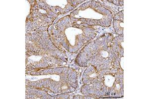 IHC analysis of BBS9 using anti-BBS9 antibody (ABIN7601518). (BBS9 anticorps  (AA 37-793))