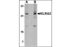 Western blot analysis of KLRA2 in mouse spleen tissue lysate with this product at (A) 0. (Klra2 anticorps  (C-Term))