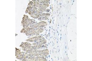 Immunohistochemistry of paraffin-embedded mouse stomach using ATP1B1 antibody (ABIN5973412) at dilution of 1/100 (40x lens). (ATP1B1 anticorps)