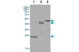 Western blot analysis using KARS monoclonal antibody, clone 8G12C1  against truncated Trx-KARS recombinant protein (1), truncated MBP-KARS (aa 90-174) and full length KARS (aa 1-188) transfected CHO-K1 cell lysate (3). (KARS anticorps)