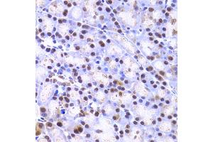 Immunohistochemistry of paraffin-embedded rat pancreas using XRCC4 Antibody (ABIN5970836) at dilution of 1/200 (40x lens). (XRCC4 anticorps)