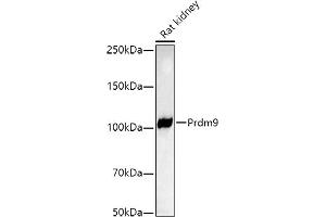 Western blot analysis of extracts of Rat kidney, using Prdm9 antibody (ABIN7269500) at 1:1000 dilution. (PRDM9 anticorps)