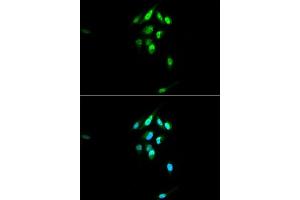 Immunofluorescence analysis of U2OS cells using NR3C1 antibody. (Glucocorticoid Receptor anticorps  (AA 1-280))
