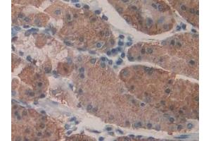 Detection of KARS in Human Stomach Tissue using Polyclonal Antibody to Lysyl tRNA Synthetase (KARS)