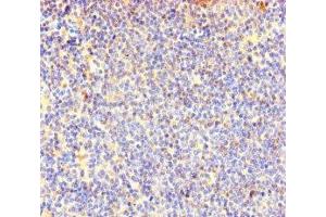 Immunohistochemistry of paraffin-embedded human lymphoid tissue using ABIN7147985 at dilution of 1:100