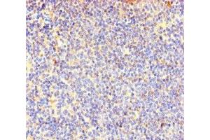 Immunohistochemistry of paraffin-embedded human lymphoid tissue using ABIN7147985 at dilution of 1:100 (COTL1 anticorps  (AA 2-142))