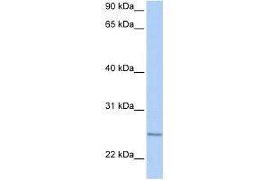 WB Suggested Anti-RABL4 Antibody Titration:  0. (RABL4 anticorps  (C-Term))
