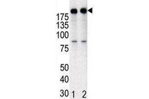 Western blot analysis of anti-HER2 in T47D cell lysate, either noninduced (Lane 1) or induced with HRG (2).
