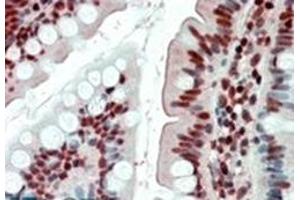 Image no. 2 for anti-Ewing Sarcoma Breakpoint Region 1 (EWSR1) (Internal Region) antibody (ABIN375098) (EWSR1 anticorps  (Internal Region))