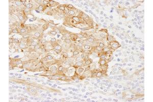 Immunohistochemistry (IHC) image for anti-Reticulocalbin 1, EF-Hand Calcium Binding Domain (RCN1) (AA 1-75) antibody (ABIN7449011) (RCN1 anticorps  (AA 1-75))