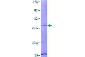 Image no. 1 for Fast Skeletal Troponin I (TNNI2) (AA 1-182) protein (GST tag) (ABIN1323279)
