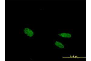 Immunofluorescence of purified MaxPab antibody to VDR on HeLa cell.