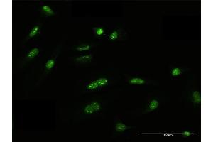 Immunofluorescence of purified MaxPab antibody to FRG1 on HeLa cell. (FRG1 anticorps  (AA 1-258))