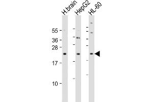All lanes : Anti-PNOC Antibody (Center) at 1:4000 dilution Lane 1: human brain lysate Lane 2: HepG2 whole cell lysate Lane 3: HL-60 whole cell lysate Lysates/proteins at 20 μg per lane. (PNOC anticorps  (AA 126-151))
