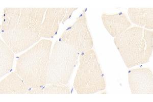 Detection of CASP9 in Human Skeletal muscle Tissue using Polyclonal Antibody to Caspase 9 (CASP9)