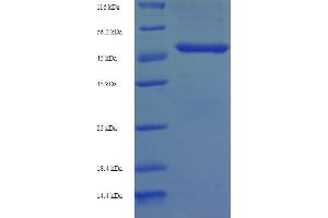 SDS-PAGE (SDS) image for Glutaminyl-Peptide Cyclotransferase (QPCT) (AA 29-361) protein (His-SUMO Tag) (ABIN5710199)