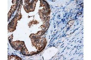 Immunohistochemical staining of paraffin-embedded Kidney tissue using anti-RALBP1 mouse monoclonal antibody.