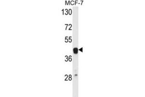 Western Blotting (WB) image for anti-V-Ets Erythroblastosis Virus E26 Oncogene Homolog 2 (ETS2) antibody (ABIN3004344) (ETS2 anticorps)