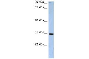 C16ORF65 antibody used at 1 ug/ml to detect target protein.
