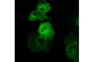 Image no. 9 for anti-Bruton Agammaglobulinemia tyrosine Kinase (BTK) antibody (ABIN1496974) (BTK anticorps)