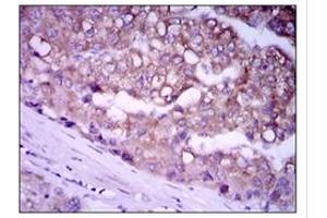 Immunohistochemistry (IHC) image for anti-Glypican 3 (GPC3) antibody (ABIN1107403) (Glypican 3 anticorps)